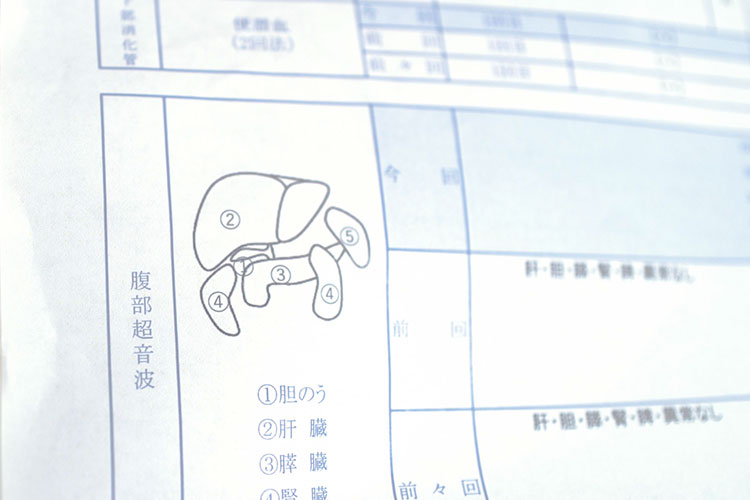 脂肪肝イメージ